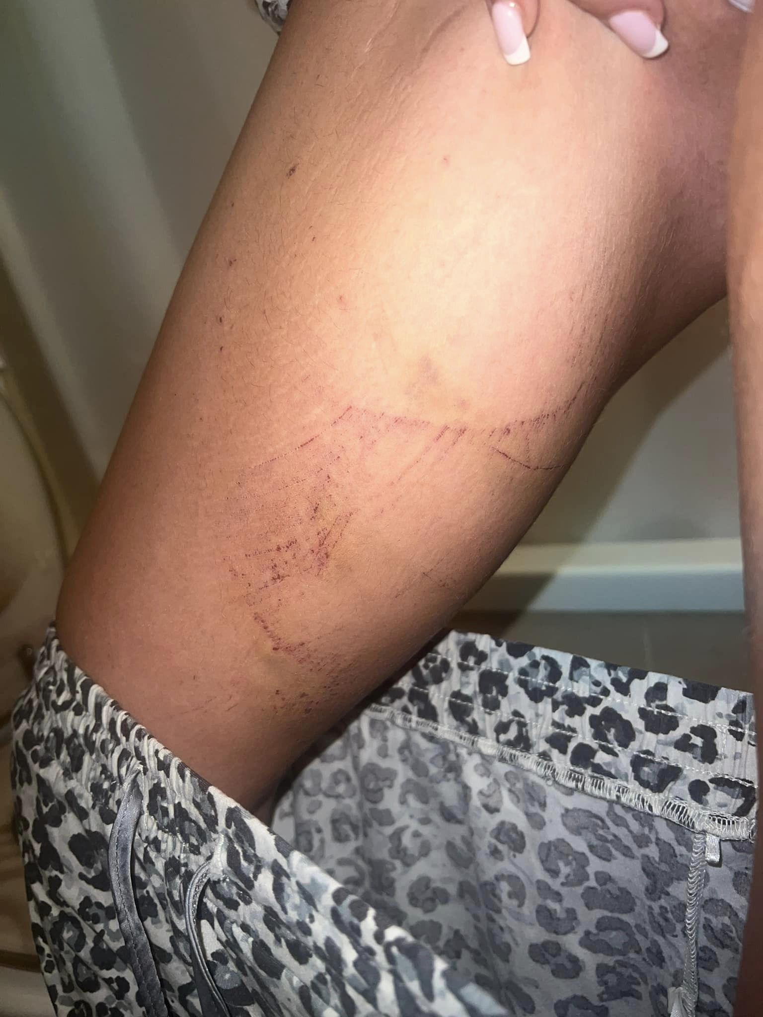 Leg with scratches