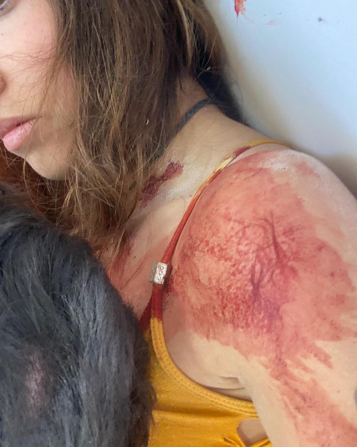 Eden's shoulder and neck are covered in blood