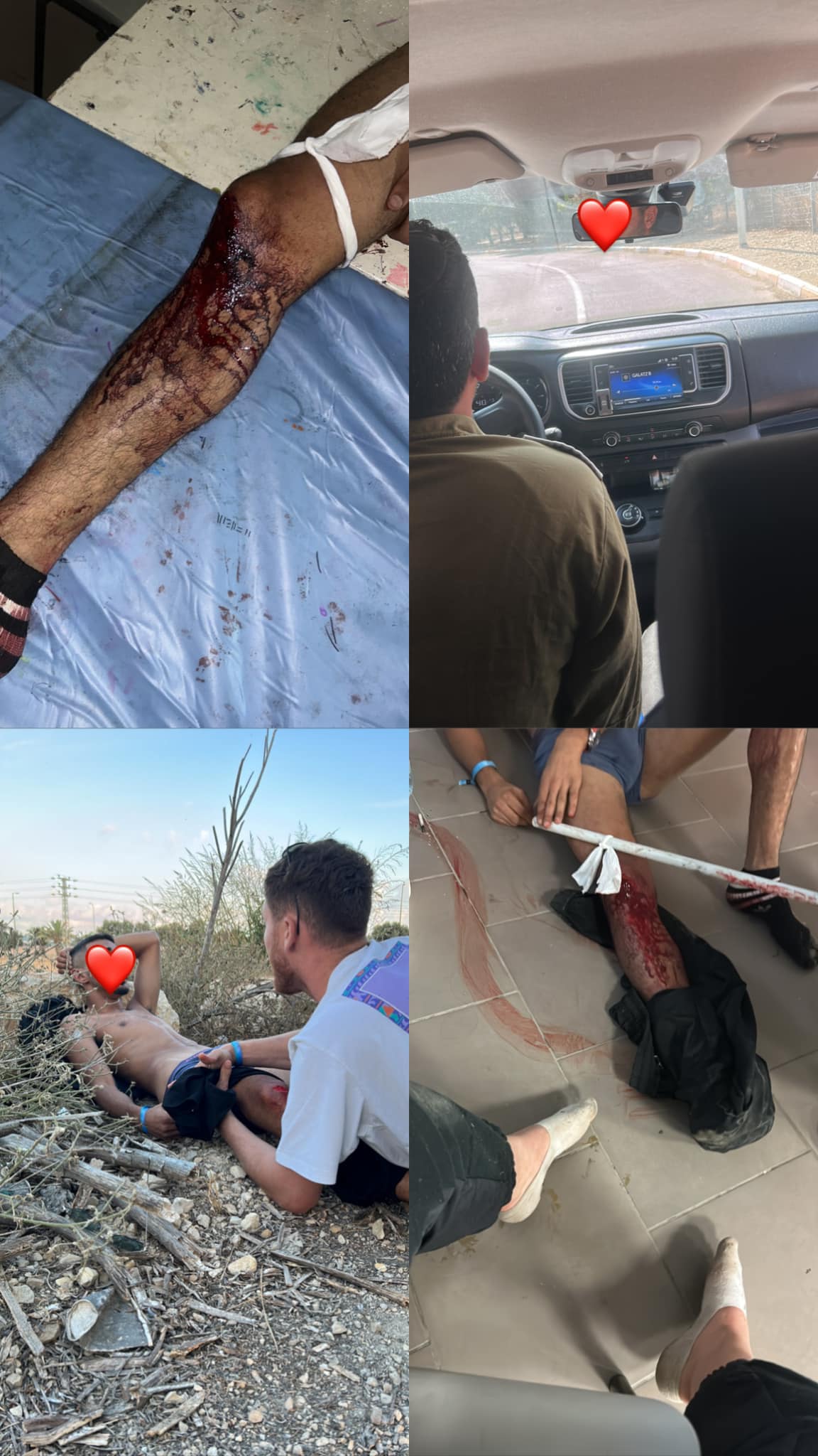 Shaked's gunshot wound at the Nova festival - 3