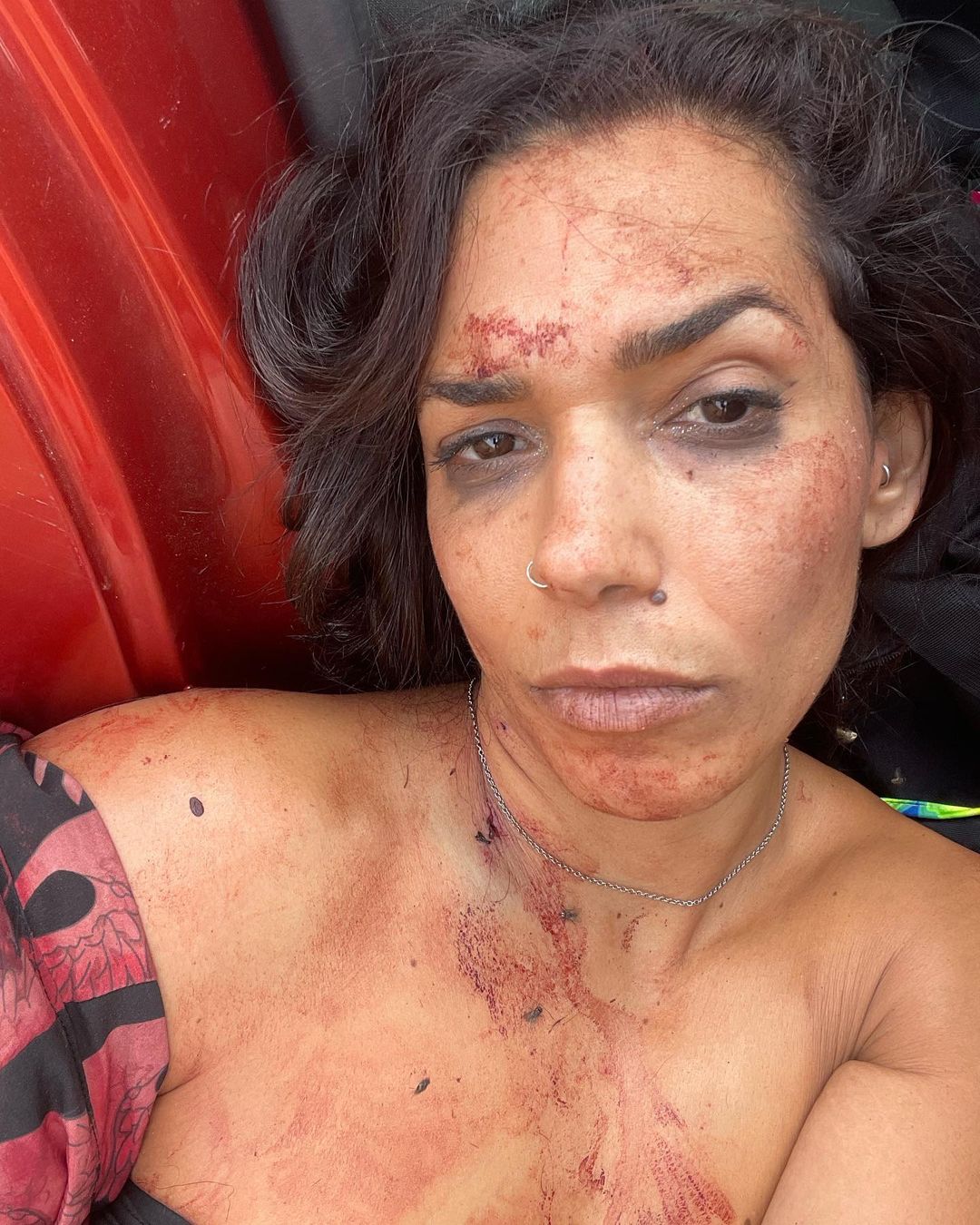 Shani's face covered in blood