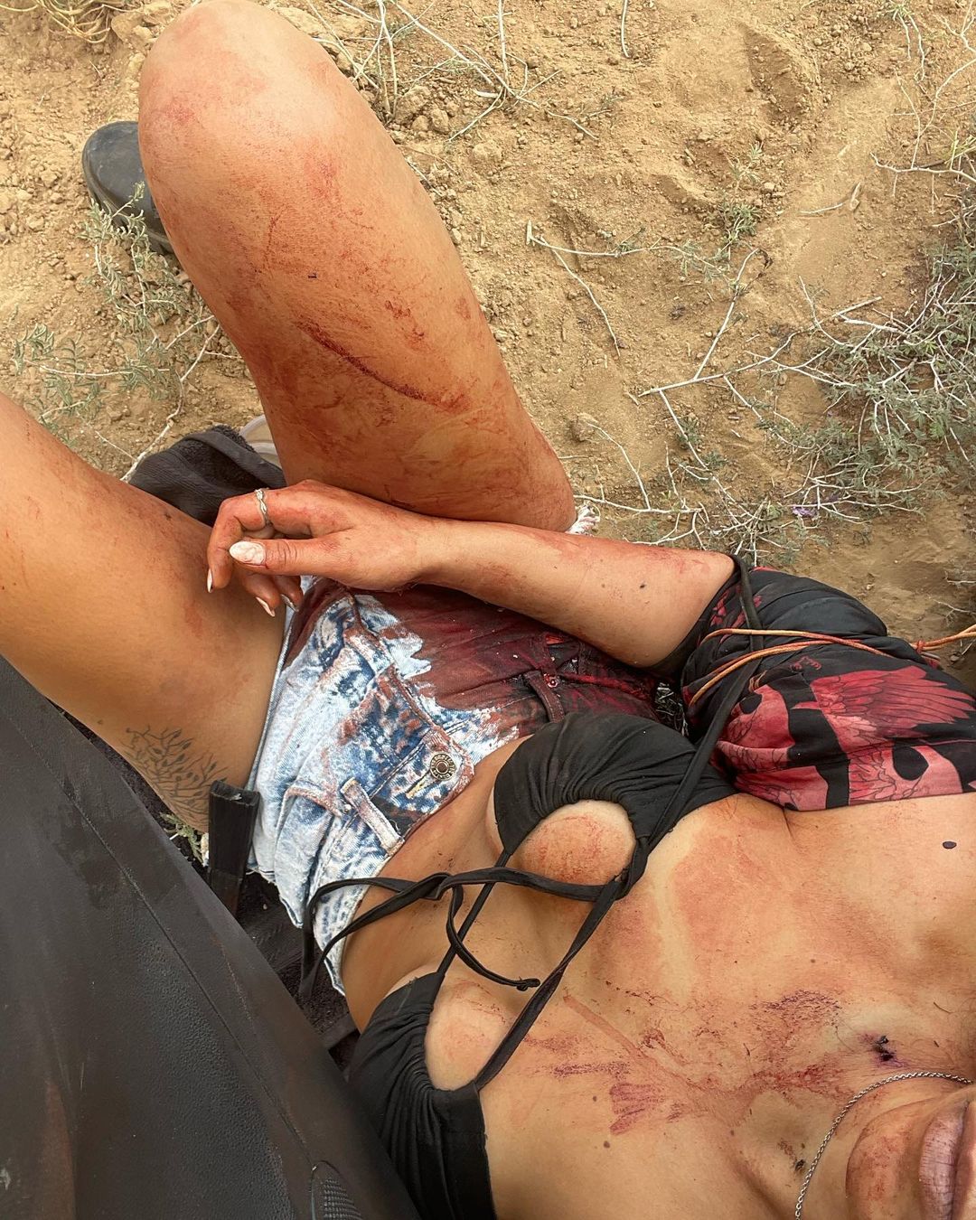 Shani with a bleeding shoulder and blood on her body